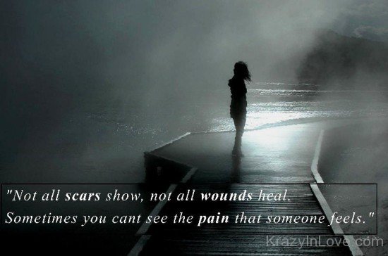 Not All Scars Show-ed135